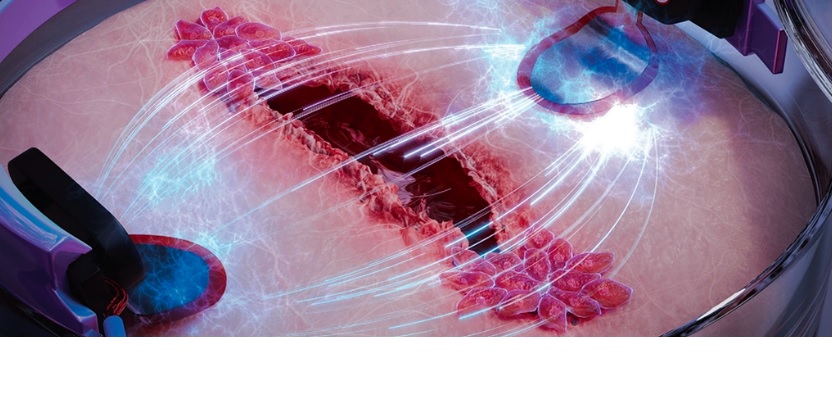 La electricidad puede curar heridas