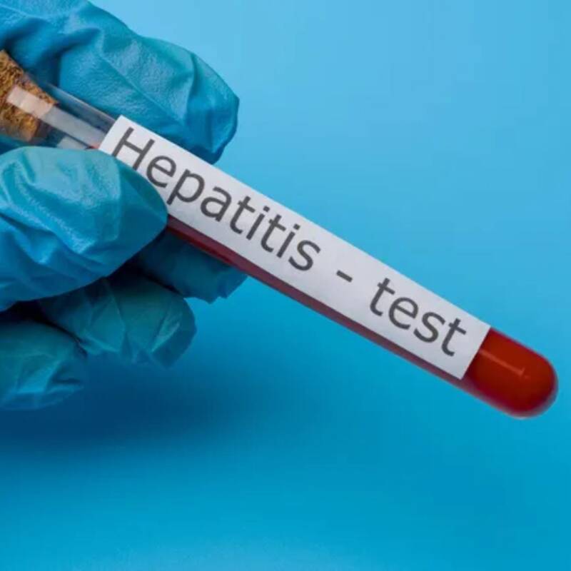 Brote de hepatitis A en Argentina