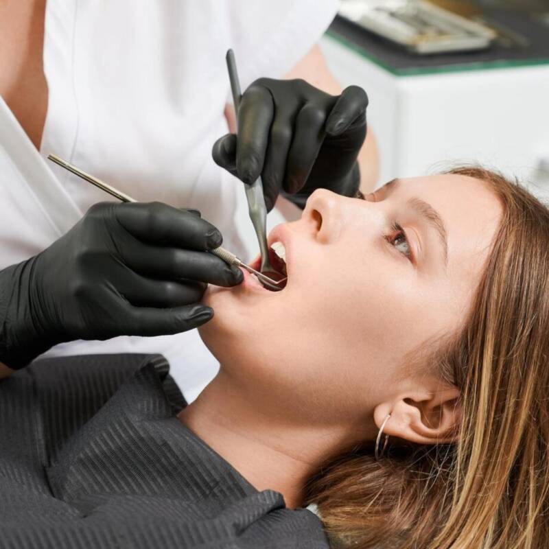 El almidón también puede causar caries