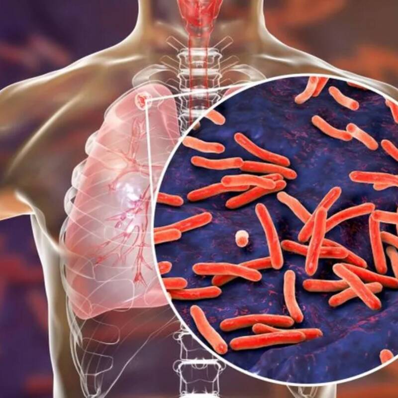 El CONICET desarrolló un método rápido, económico y sin cultivo para diagnosticar tuberculosis