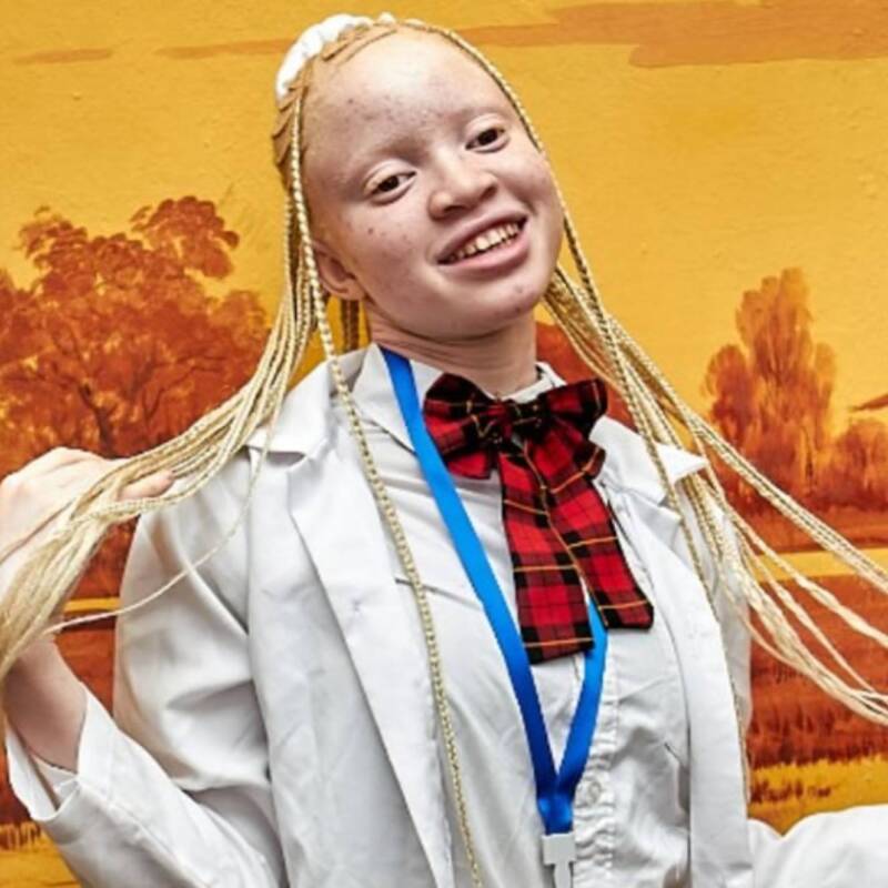 Una adolescente creó un protector solar orgánico para personas con albinismo